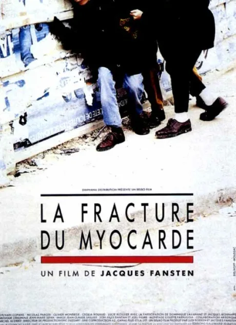 Лечение миокарда (1990)